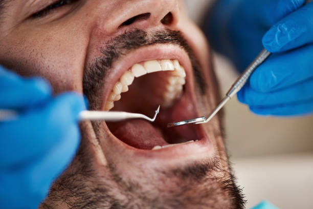 Emergency Dental Services in Waterville, WA